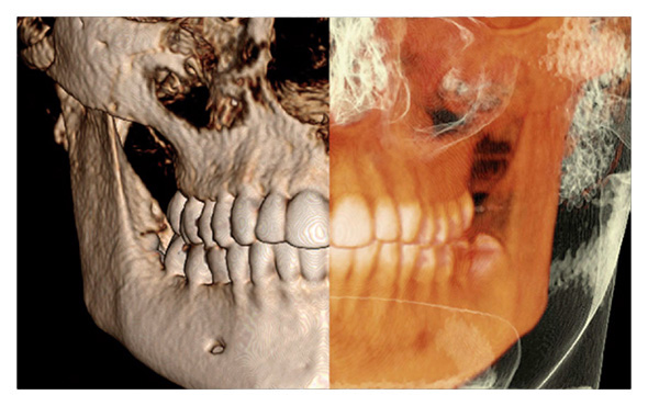 Tomograf�a 3D - Cone Beam